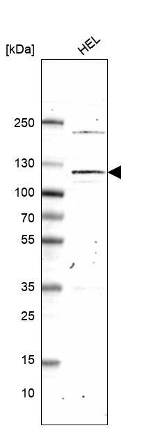 PMS1 Antibody (CL14436) - Azide and BSA Free Western Blot: PMS1 Antibody [NBP3-44308]