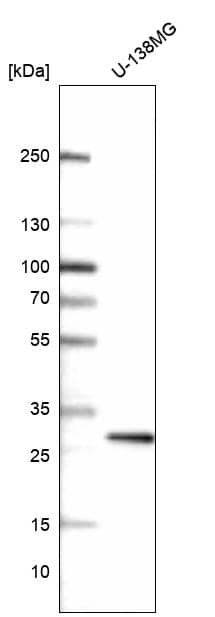 PRRX1 Antibody (CL14469) - Azide and BSA Free Western Blot: PRRX1 Antibody [NBP3-44309]