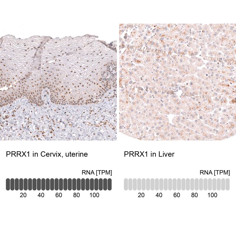 PRRX1 Antibody (CL14471) - Azide and BSA Free Immunohistochemistry-Paraffin: PRRX1 Antibody [NBP3-44310]