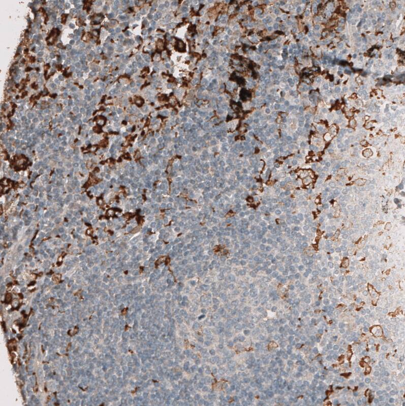 AIF-1/Iba1 Antibody (CL10930) - Azide and BSA Free Immunohistochemistry-Paraffin: AIF-1/Iba1 Antibody [NBP3-44311]