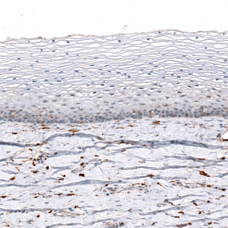 AIF-1/Iba1 Antibody (CL10930) - Azide and BSA Free Immunohistochemistry-Paraffin: AIF-1/Iba1 Antibody [NBP3-44311]