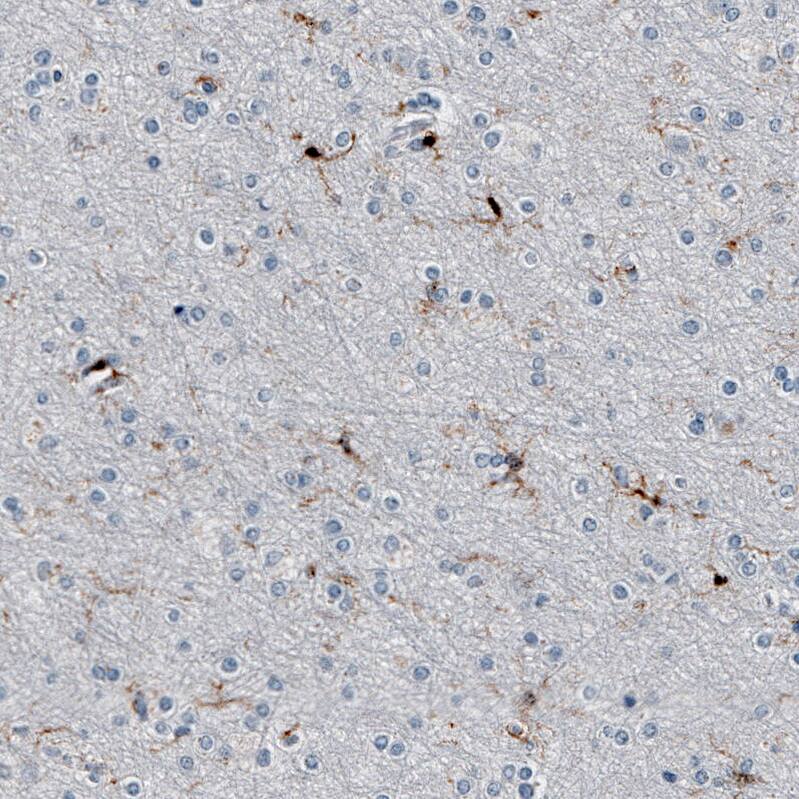 AIF-1/Iba1 Antibody (CL10936) - Azide and BSA Free Immunohistochemistry-Paraffin: AIF-1/Iba1 Antibody [NBP3-44312]