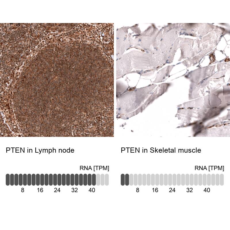 PTEN Antibody (CL11722) - Azide and BSA Free Immunohistochemistry-Paraffin: PTEN Antibody [NBP3-44313]