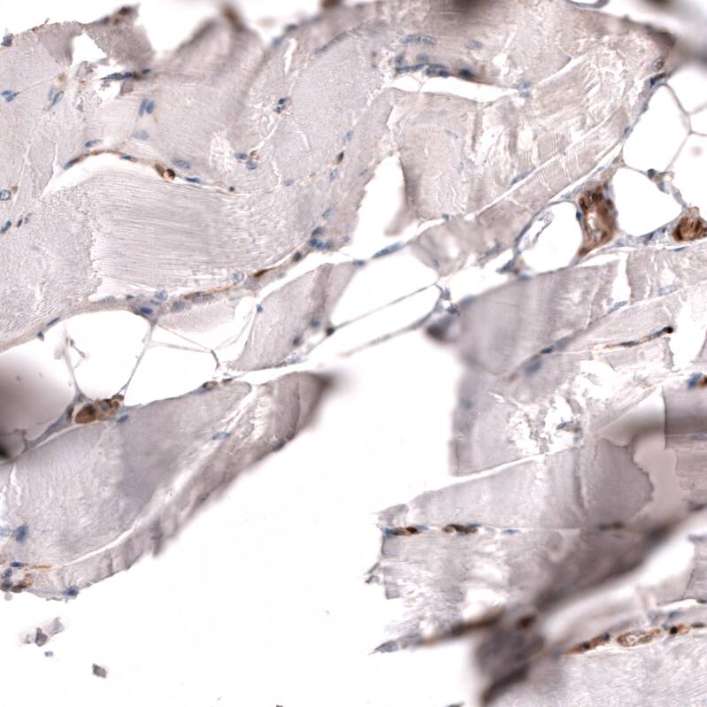 PTEN Antibody (CL11722) - Azide and BSA Free Immunohistochemistry-Paraffin: PTEN Antibody [NBP3-44313]