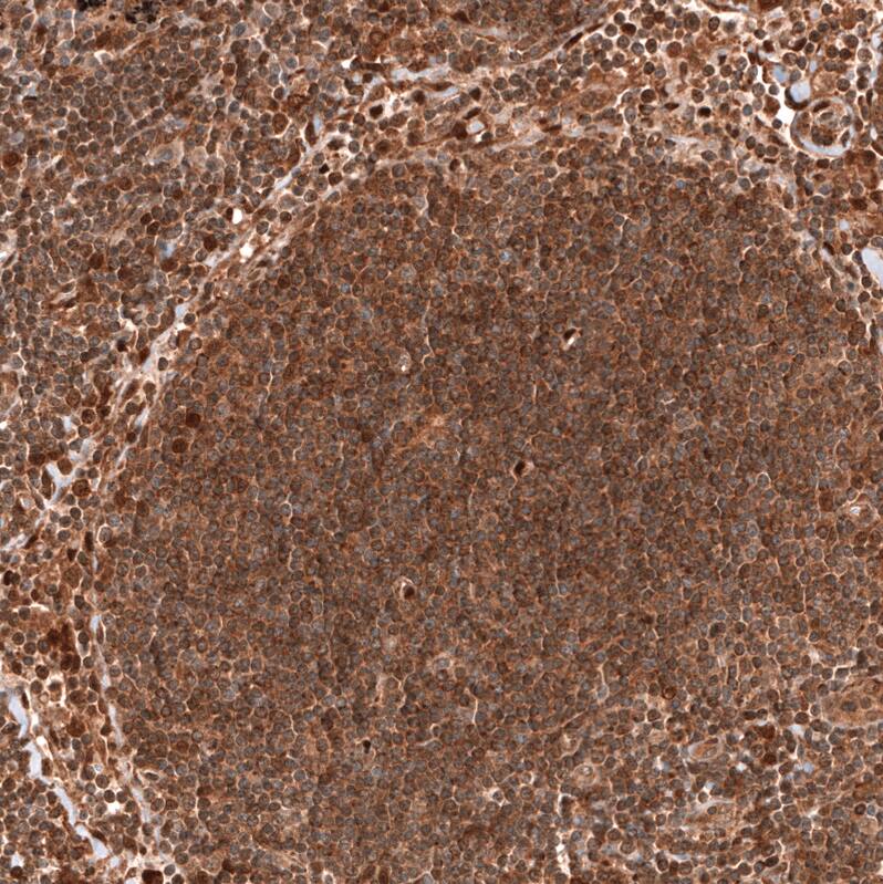 PTEN Antibody (CL11722) - Azide and BSA Free Immunohistochemistry-Paraffin: PTEN Antibody [NBP3-44313]