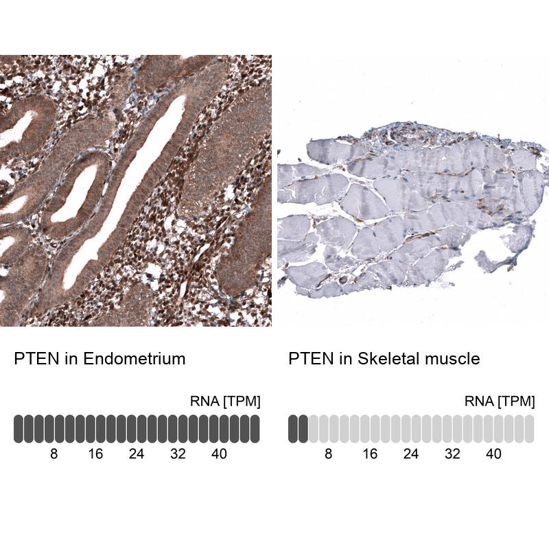 PTEN Antibody (CL11723) - Azide and BSA Free Immunohistochemistry-Paraffin: PTEN Antibody [NBP3-44314]