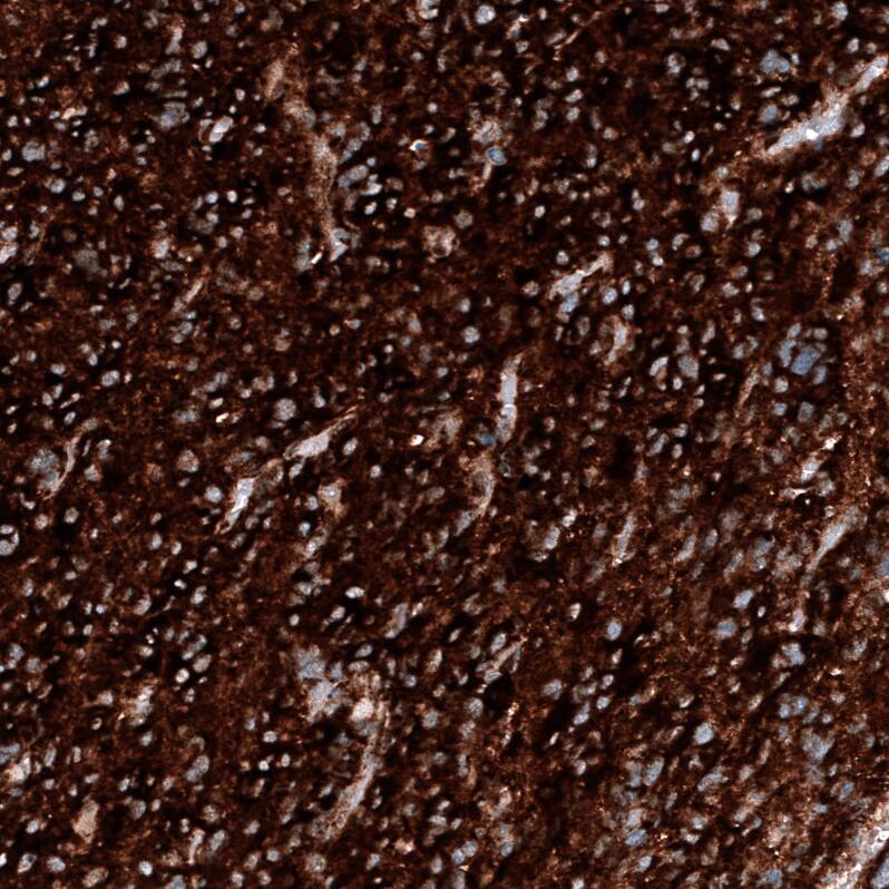 PTEN Antibody (CL11723) - Azide and BSA Free Immunohistochemistry-Paraffin: PTEN Antibody [NBP3-44314]