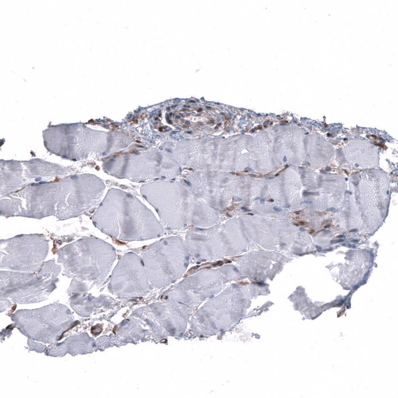 PTEN Antibody (CL11723) - Azide and BSA Free Immunohistochemistry-Paraffin: PTEN Antibody [NBP3-44314]