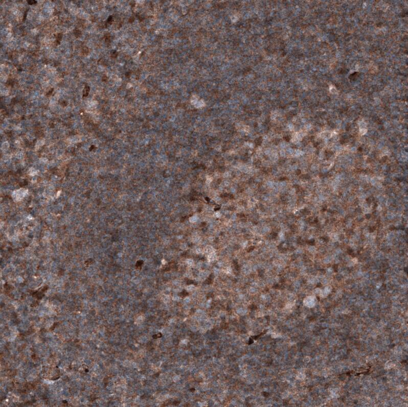 PTEN Antibody (CL11723) - Azide and BSA Free Immunohistochemistry-Paraffin: PTEN Antibody [NBP3-44314]