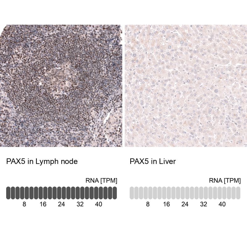 Pax5/BSAP Antibody (CL14550) - Azide and BSA Free Immunohistochemistry-Paraffin: Pax5/BSAP Antibody [NBP3-44317]