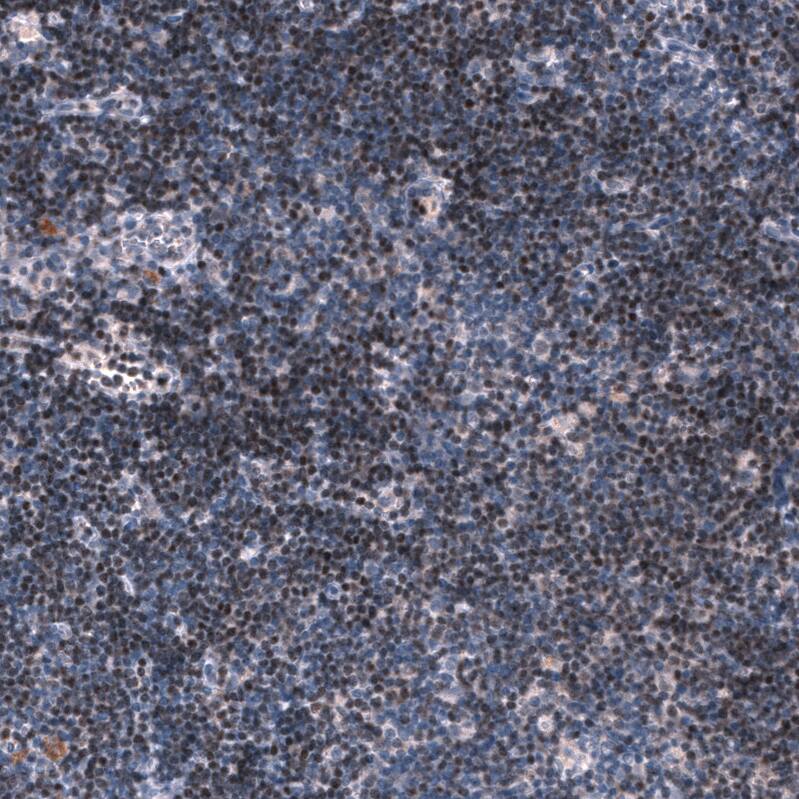 Pax5/BSAP Antibody (CL14550) - Azide and BSA Free Immunohistochemistry-Paraffin: Pax5/BSAP Antibody [NBP3-44317]