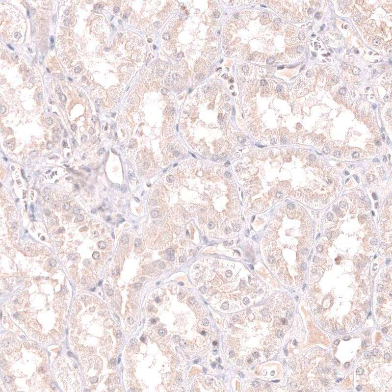 Pax5/BSAP Antibody (CL14550) - Azide and BSA Free Immunohistochemistry-Paraffin: Pax5/BSAP Antibody [NBP3-44317]