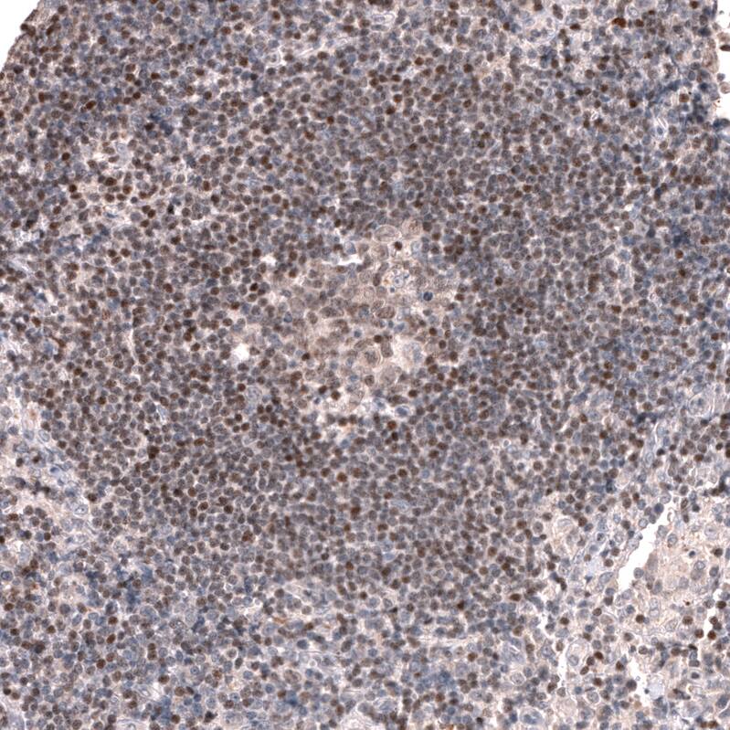 Pax5/BSAP Antibody (CL14550) - Azide and BSA Free Immunohistochemistry-Paraffin: Pax5/BSAP Antibody [NBP3-44317]