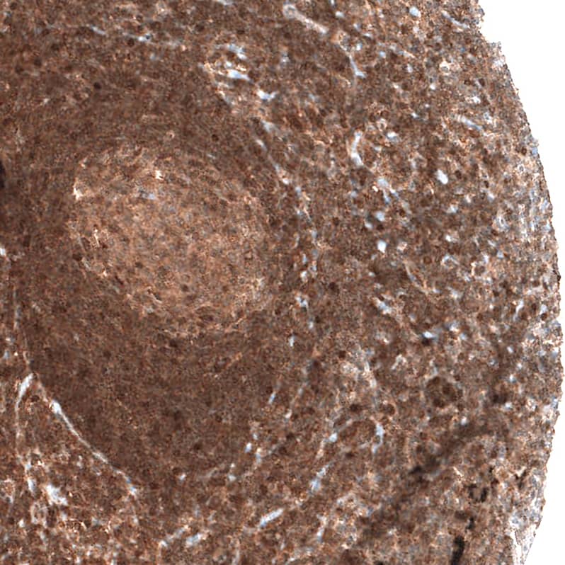 Bax Antibody (CL7919) - Azide and BSA Free Immunohistochemistry-Paraffin: Bax Antibody [NBP3-44320]