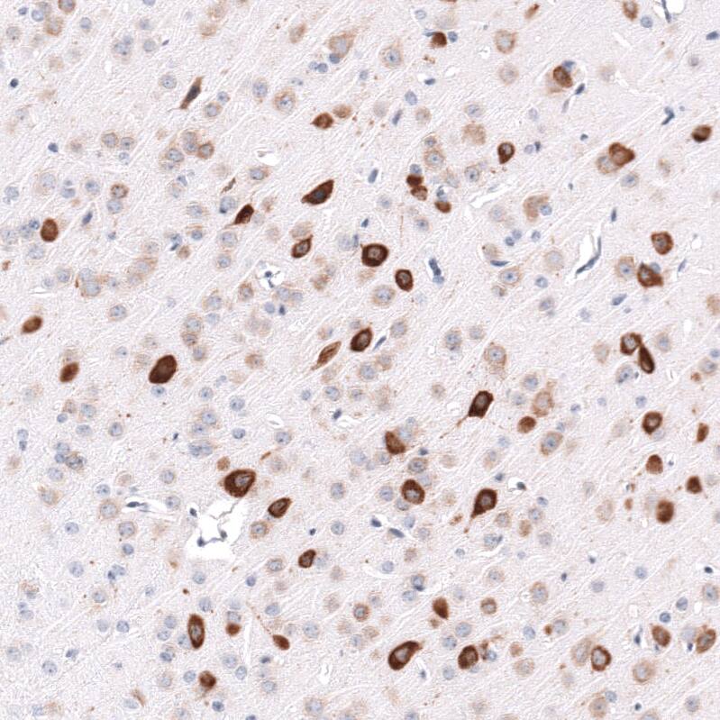 ELAVL2 Antibody (CL15323) - Azide and BSA Free Immunohistochemistry-Paraffin: ELAVL2 Antibody [NBP3-44321]