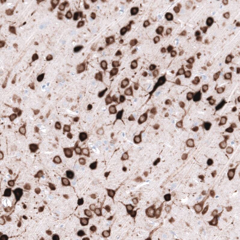 ELAVL2 Antibody (CL15329) - Azide and BSA Free Immunohistochemistry-Paraffin: ELAVL2 Antibody [NBP3-44322]