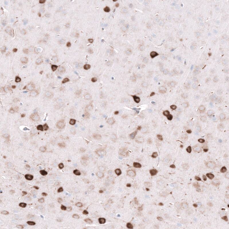 ELAVL2 Antibody (CL15329) - Azide and BSA Free Immunohistochemistry-Paraffin: ELAVL2 Antibody [NBP3-44322]