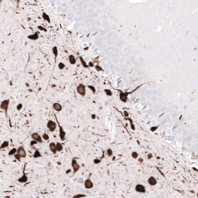 ELAVL2 Antibody (CL15329) - Azide and BSA Free Immunohistochemistry-Paraffin: ELAVL2 Antibody [NBP3-44322]