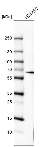 IL-10R alpha Antibody (CL8203) - Azide and BSA Free Western Blot: IL-10R alpha Antibody [NBP3-44323]