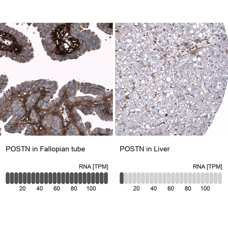 Periostin/OSF-2 Antibody (CL12090) - Azide and BSA Free Immunohistochemistry-Paraffin: Periostin/OSF-2 Antibody [NBP3-44324]