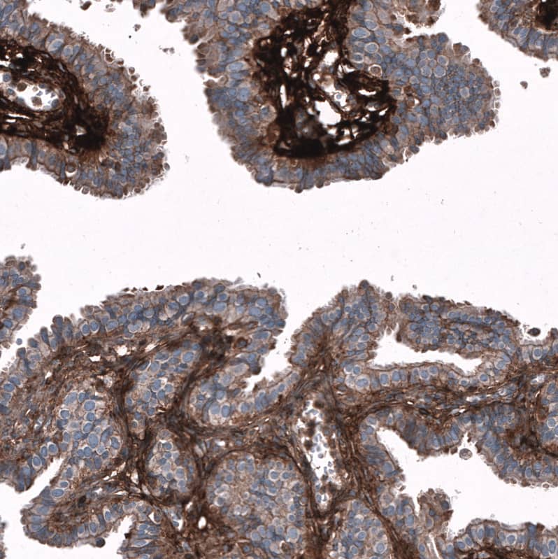 Periostin/OSF-2 Antibody (CL12090) - Azide and BSA Free Immunohistochemistry-Paraffin: Periostin/OSF-2 Antibody [NBP3-44324]