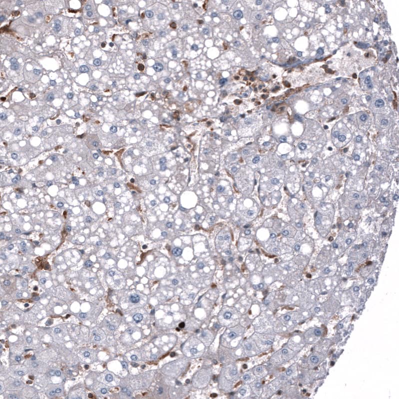 Periostin/OSF-2 Antibody (CL12090) - Azide and BSA Free Immunohistochemistry-Paraffin: Periostin/OSF-2 Antibody [NBP3-44324]
