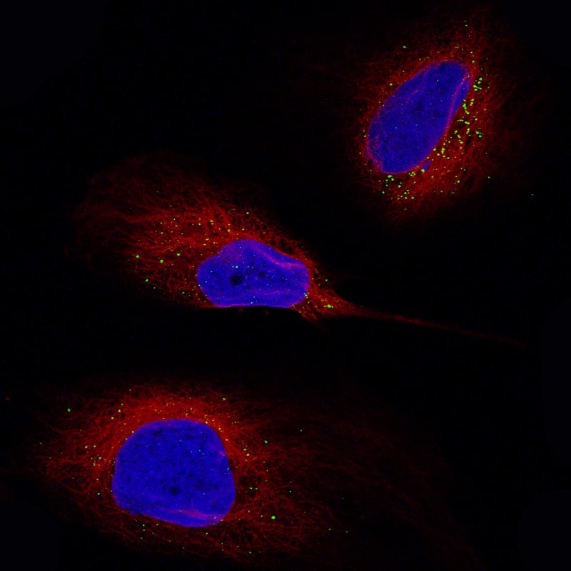 Periostin/OSF-2 Antibody (CL12090) - Azide and BSA Free Immunocytochemistry/ Immunofluorescence: Periostin/OSF-2 Antibody [NBP3-44324]