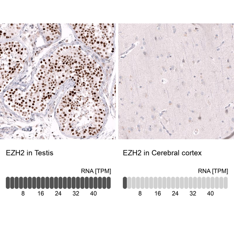 EZH2/KMT6 Antibody (CL11915) - Azide and BSA Free Immunohistochemistry-Paraffin: EZH2/KMT6 Antibody [NBP3-44326]