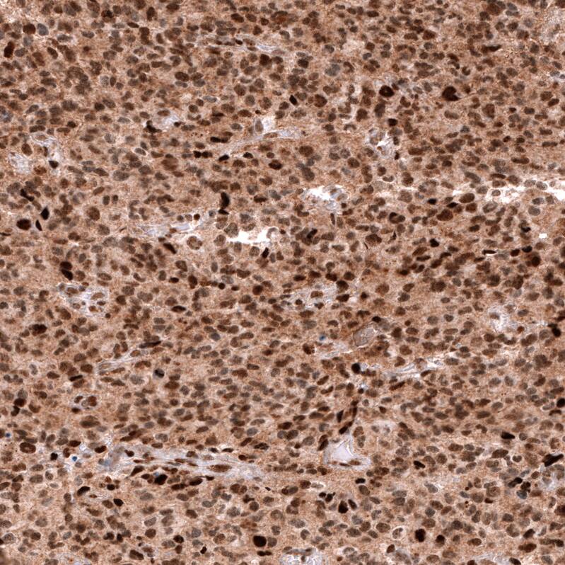 EZH2/KMT6 Antibody (CL11915) - Azide and BSA Free Immunohistochemistry-Paraffin: EZH2/KMT6 Antibody [NBP3-44326]