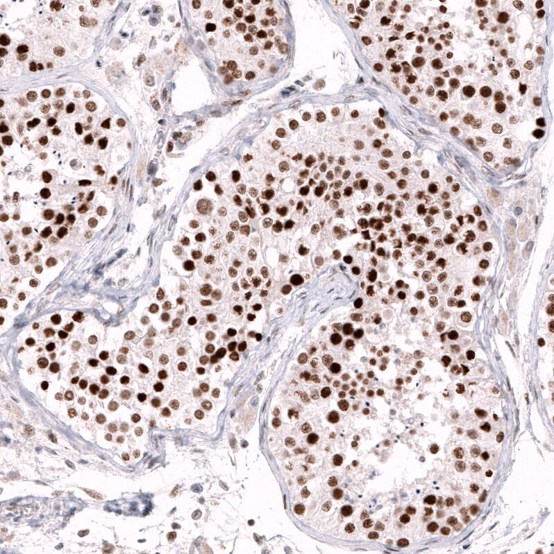 EZH2/KMT6 Antibody (CL11915) - Azide and BSA Free Immunohistochemistry-Paraffin: EZH2/KMT6 Antibody [NBP3-44326]