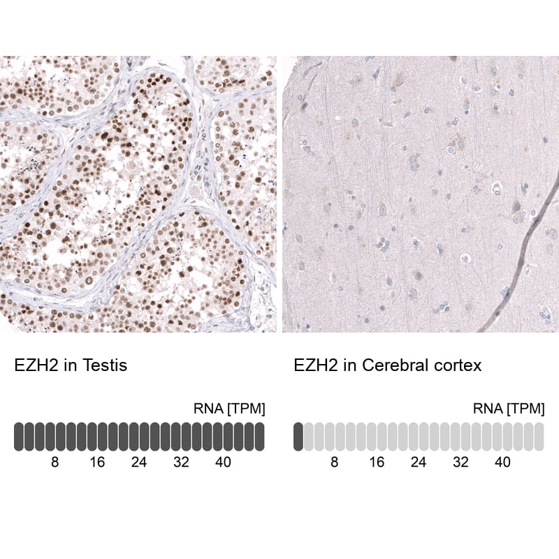 EZH2/KMT6 Antibody (CL11945) - Azide and BSA Free Immunohistochemistry-Paraffin: EZH2/KMT6 Antibody [NBP3-44327]