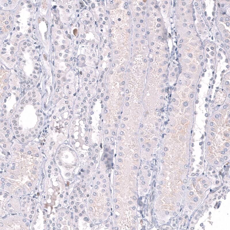 EZH2/KMT6 Antibody (CL11945) - Azide and BSA Free Immunohistochemistry-Paraffin: EZH2/KMT6 Antibody [NBP3-44327]