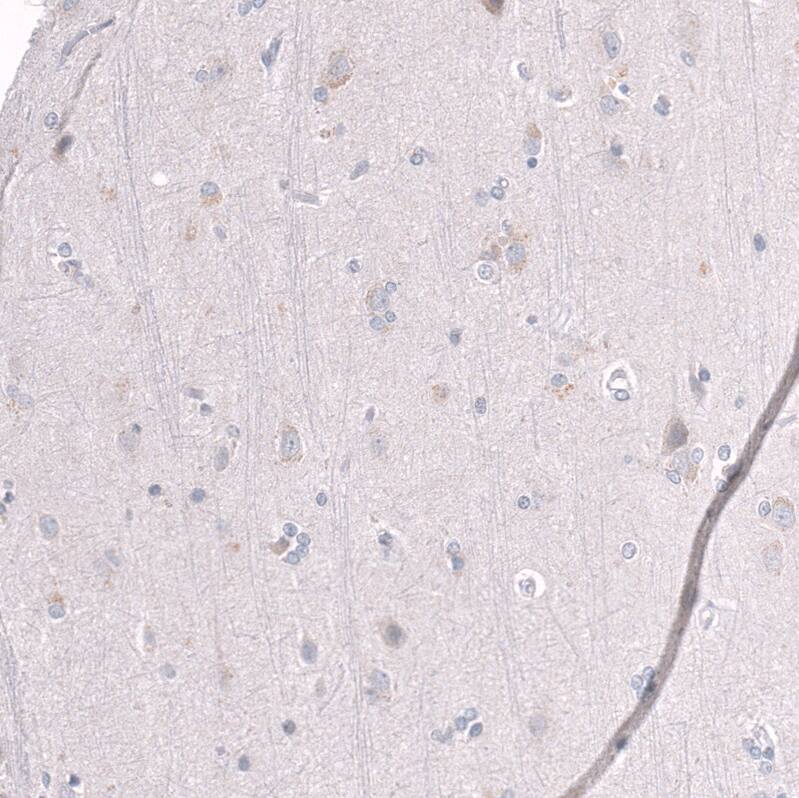EZH2/KMT6 Antibody (CL11945) - Azide and BSA Free Immunohistochemistry-Paraffin: EZH2/KMT6 Antibody [NBP3-44327]