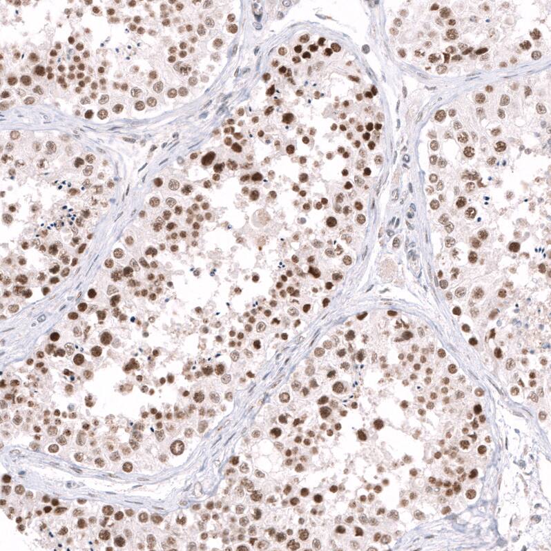 EZH2/KMT6 Antibody (CL11945) - Azide and BSA Free Immunohistochemistry-Paraffin: EZH2/KMT6 Antibody [NBP3-44327]