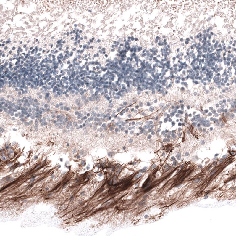 ABCB5 Antibody (CL13618) - Azide and BSA Free Immunohistochemistry-Paraffin: ABCB5 Antibody [NBP3-44328]