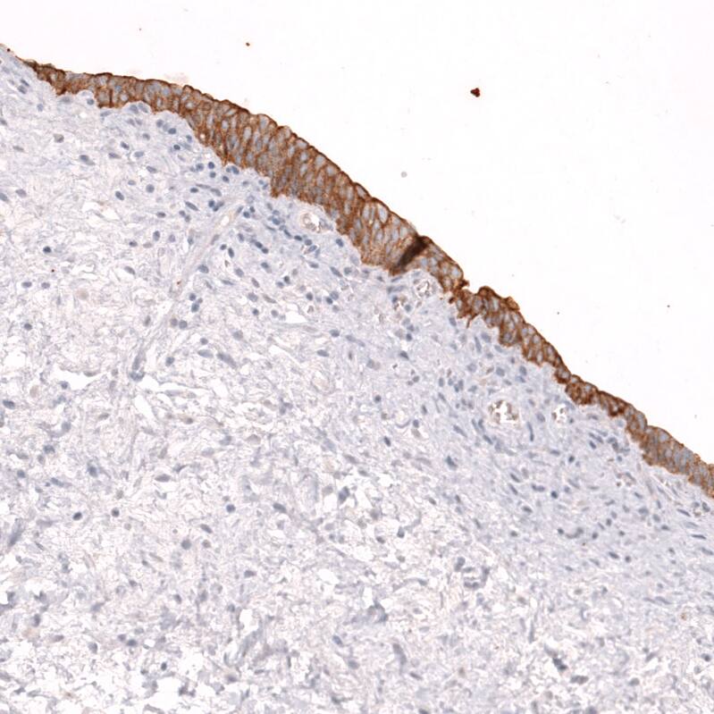 ABCB5 Antibody (CL13618) - Azide and BSA Free Immunohistochemistry-Paraffin: ABCB5 Antibody [NBP3-44328]