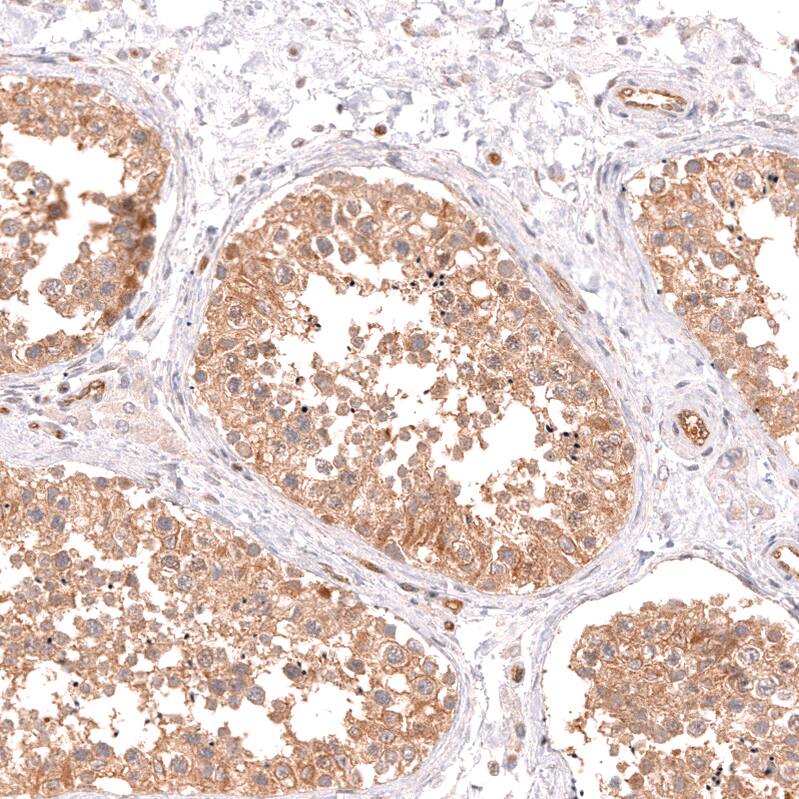 TYKi Antibody (CL14479) - Azide and BSA Free Immunohistochemistry-Paraffin: TYKi Antibody [NBP3-44329]