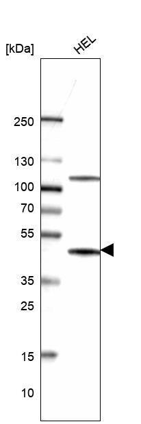 TYKi Antibody (CL14479) - Azide and BSA Free Western Blot: TYKi Antibody [NBP3-44329]