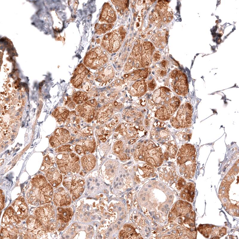 TYKi Antibody (CL14479) - Azide and BSA Free Immunohistochemistry-Paraffin: TYKi Antibody [NBP3-44329]