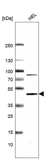 TYKi Antibody (CL14486) - Azide and BSA Free Western Blot: TYKi Antibody [NBP3-44330]