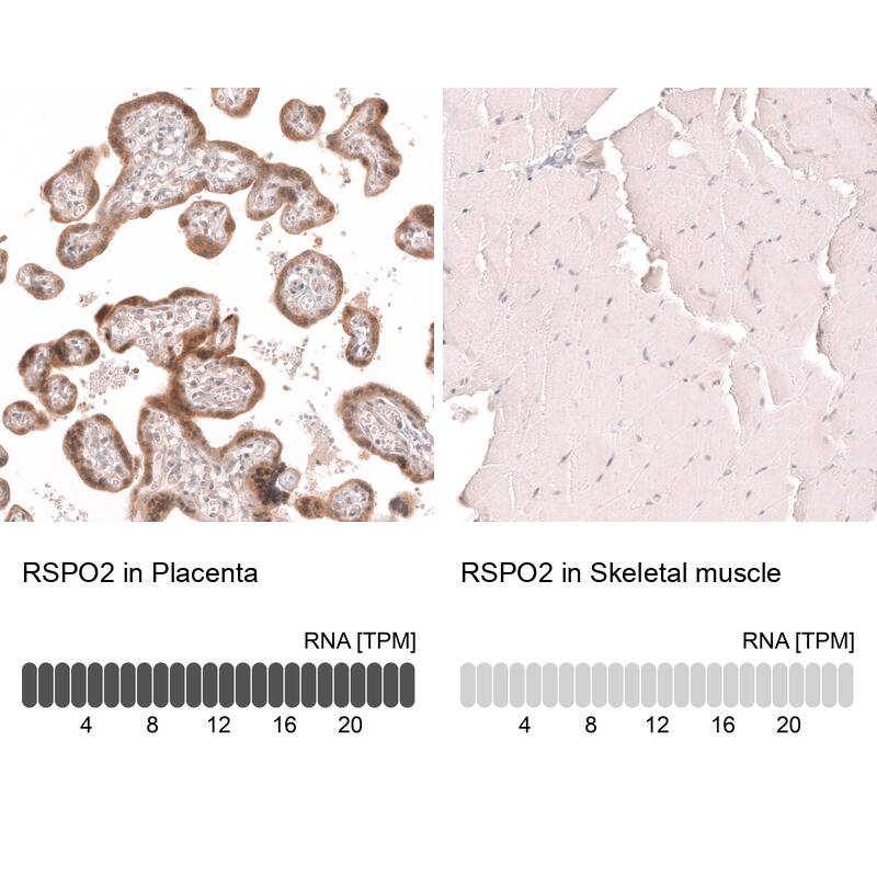 R-Spondin 2 Antibody (CL14321) - Azide and BSA Free Immunohistochemistry-Paraffin: R-Spondin 2 Antibody [NBP3-44331]