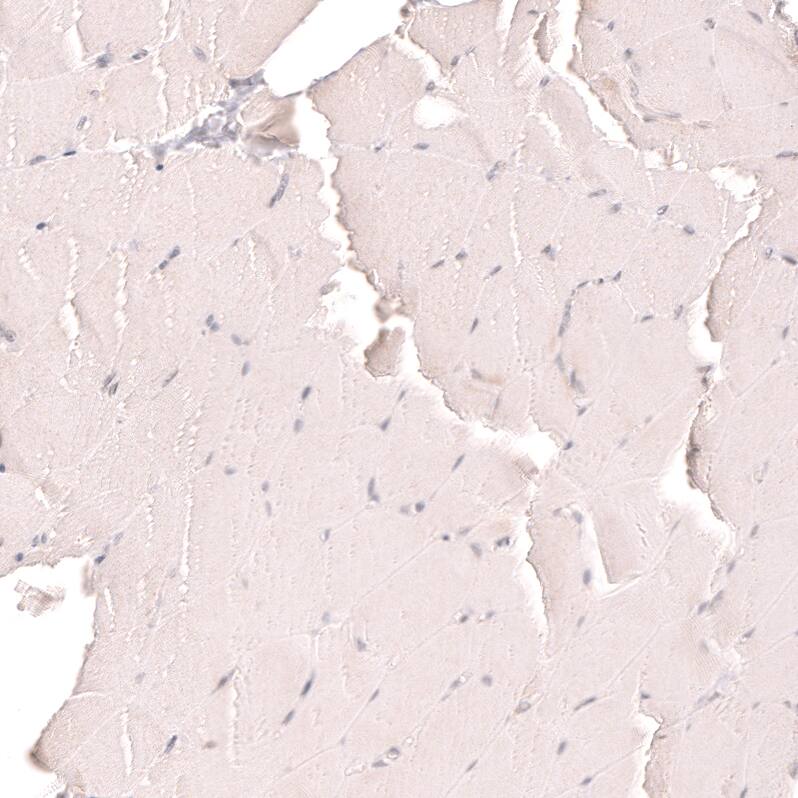 R-Spondin 2 Antibody (CL14321) - Azide and BSA Free Immunohistochemistry-Paraffin: R-Spondin 2 Antibody [NBP3-44331]