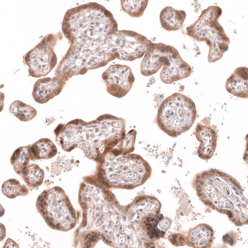 R-Spondin 2 Antibody (CL14321) - Azide and BSA Free Immunohistochemistry-Paraffin: R-Spondin 2 Antibody [NBP3-44331]