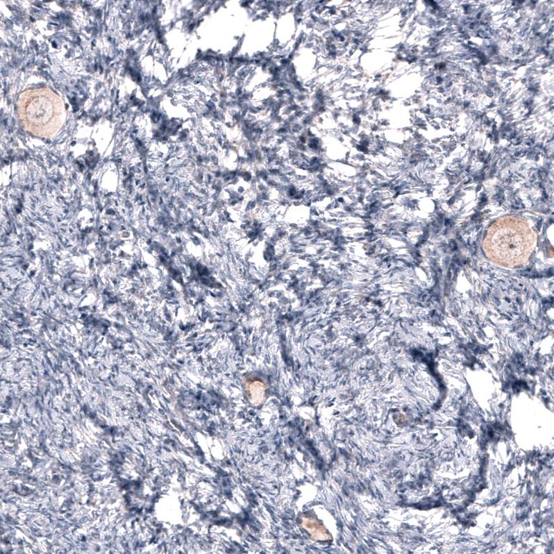 R-Spondin 2 Antibody (CL14321) - Azide and BSA Free Immunohistochemistry-Paraffin: R-Spondin 2 Antibody [NBP3-44331]