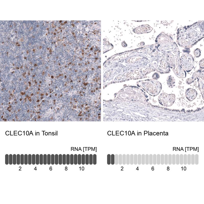 CLEC10A/CD301 Antibody (CL15513) - Azide and BSA Free Immunohistochemistry-Paraffin: CLEC10A/CD301 Antibody [NBP3-44333]