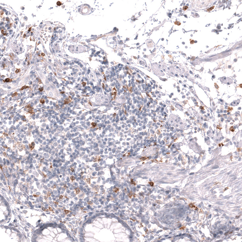 CLEC10A/CD301 Antibody (CL15513) - Azide and BSA Free Immunohistochemistry-Paraffin: CLEC10A/CD301 Antibody [NBP3-44333]