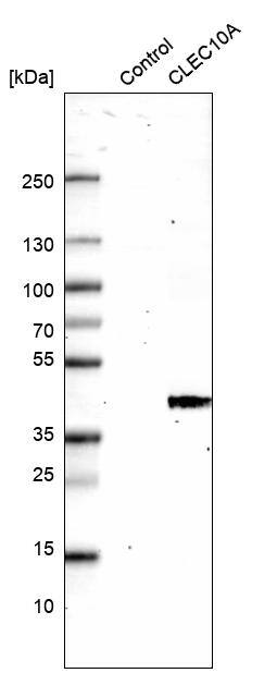 CLEC10A/CD301 Antibody (CL15513) - Azide and BSA Free Western Blot: CLEC10A/CD301 Antibody [NBP3-44333]