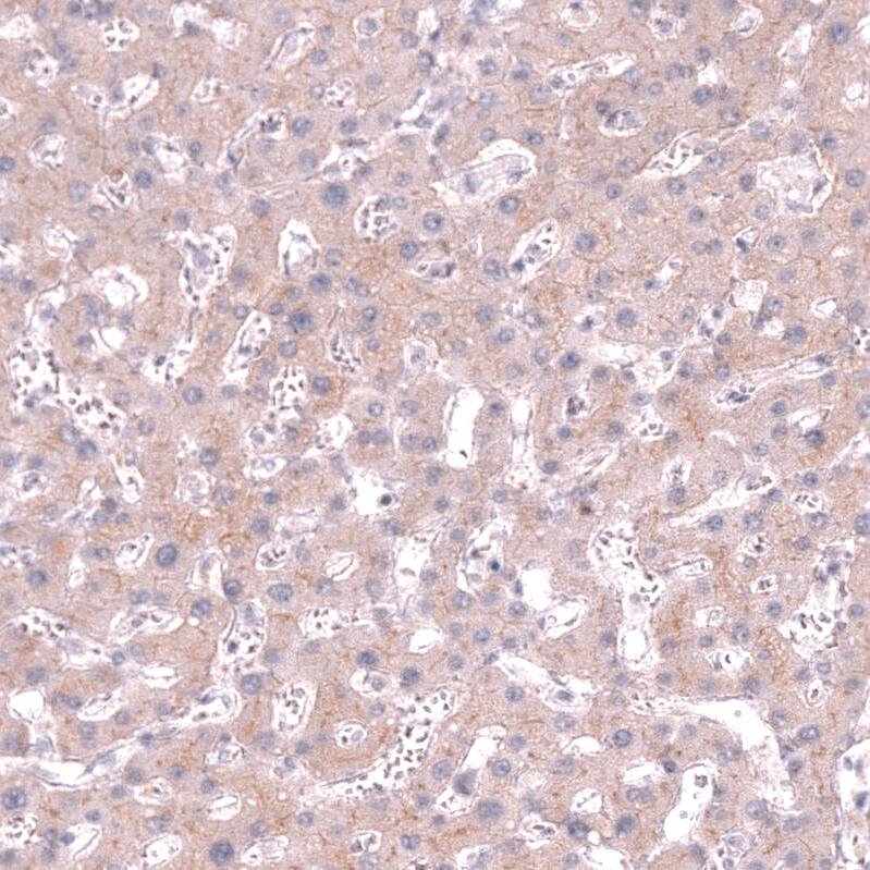 CLEC10A/CD301 Antibody (CL15523) - Azide and BSA Free Immunohistochemistry-Paraffin: CLEC10A/CD301 Antibody [NBP3-44334]