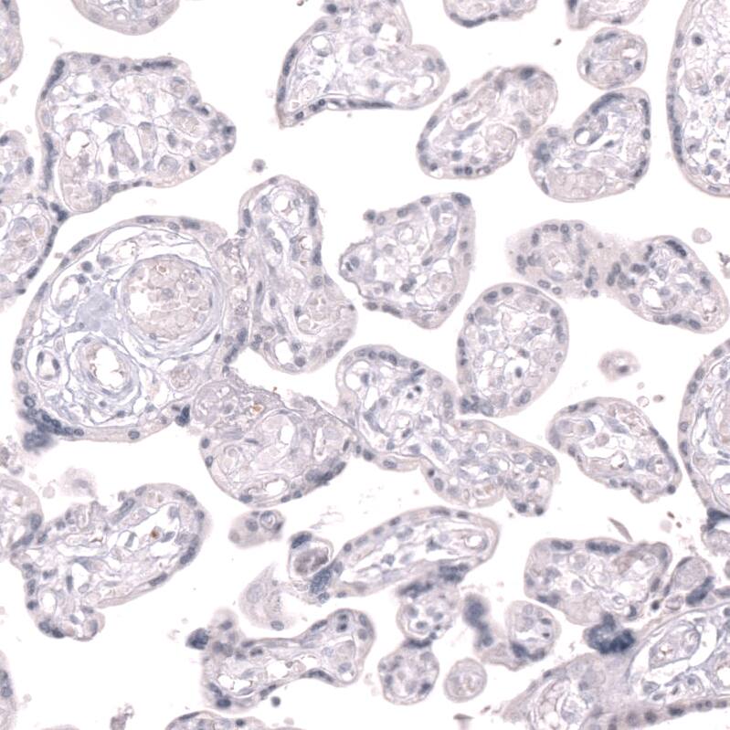 CLEC10A/CD301 Antibody (CL15523) - Azide and BSA Free Immunohistochemistry-Paraffin: CLEC10A/CD301 Antibody [NBP3-44334]