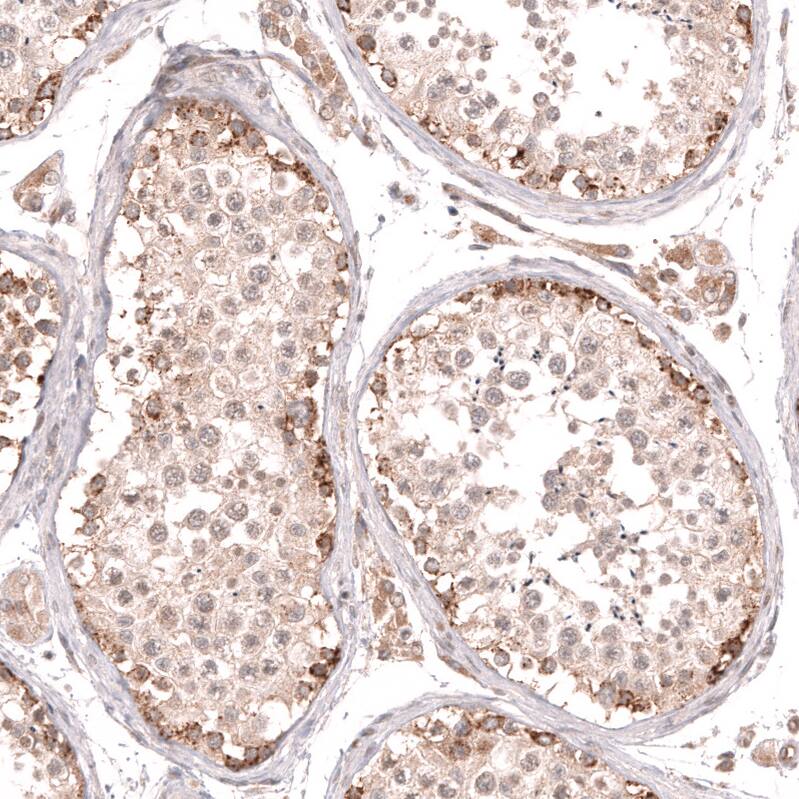 Porimin Antibody (CL14381) - Azide and BSA Free Immunohistochemistry-Paraffin: Porimin Antibody [NBP3-44335]